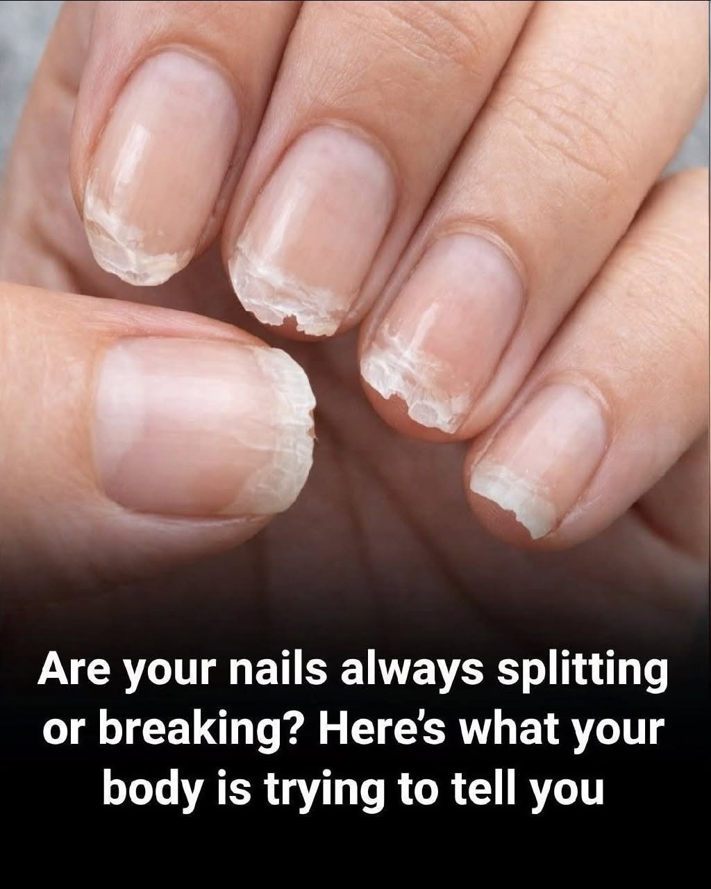 Brittle and Weak Nails: What Your Body Is Telling You