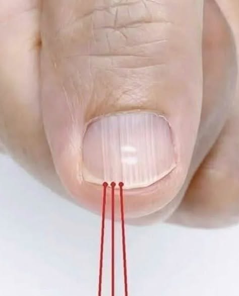 If you have these lines on your nails after 40, it is a clear sign that..