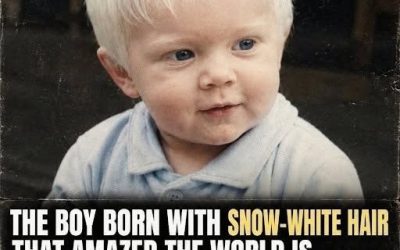 The Boy Born With Snow-White Hair – His Life Today